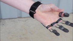 國(guó)外一家名為Naked Prosthetic的公司，設(shè)計(jì)發(fā)明出了一款高度仿生的3D打印手指，科技含量很高，用于幫助生活不遍的截肢者，使